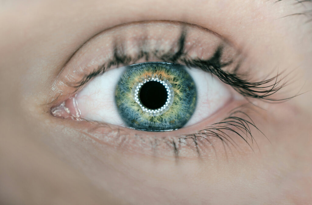 Vision